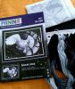 IMG_20170522_121258.thumb.jpg.50225761bcd0e0ea8d285ad90857ce7d.jpg