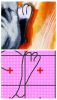 InCollage_20231110_135547580.thumb.jpg.d558881596fe07ba5d5c4483a592ea55.jpg