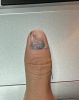 hurt.thumb.jpg.548c2c7b7233a1a875f652211946756b.jpg