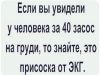 h-199057.thumb.jpg.87180b07c0b06c5a8857fece8e0827fb.jpg